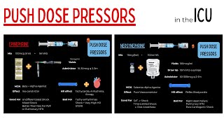 Push Dose Vasopressors For Management Of Shock In The ICU [upl. by Roberta156]