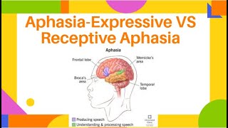 AphasiaExpressive VS Receptive Aphasia  Fluent amp NonFluent Aphasia  PhysiotherapyKnowledge [upl. by Franky]