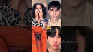 Eyes trend  dark and white eyes trend like and subscribe please [upl. by Drice]