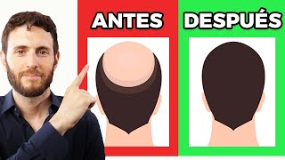 Cómo frenar la caída de pelo en hombres y mujeres [upl. by Aeslehs491]