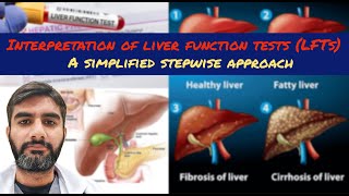 Interpretation of liver function tests LFTs [upl. by Cyd72]