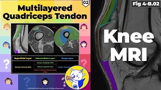 Fig 4B02 Anatomy of the Multilayered Quadriceps Tendon Part 2 [upl. by Naitsirhc]