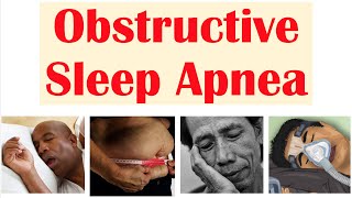 Obstructive Sleep Apnea OSA  Risk Factors Signs amp Symptoms Complications Diagnosis Treatment [upl. by Matlick]