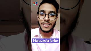 Dandruff  খুশকি  Fungal infection  Malassezia furfur  Dr Med  Sakib Rahaman [upl. by Llennahc]