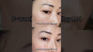 1 month vs 2 months using Alloys M4 Face Cream beforeandafter [upl. by Abdul]