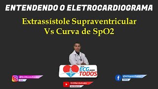 Extrassístole Supraventricular e a curva de SpO2 [upl. by Selhorst795]