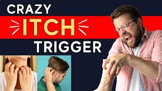 Got Itchy Skin Without Rash The SHOCKING Neuropathic Itch Trigger Explained  Dr Shawn Kwatra [upl. by Leimad612]