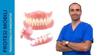 PROTESI MOBILI  Tradizionali VS Innovative Quali sono i Vantaggi  SkyDental 3D [upl. by Gaulin107]