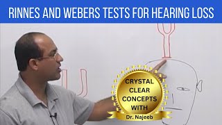 Rinnes and Webers Tests for Hearing Loss  ENT [upl. by Lladnik]