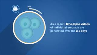 EmbryoScope Patient Information [upl. by Avraham]