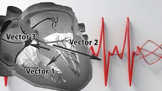 Decodificando al corazón Vectores y ECG ¡¡¡explicados facilmente [upl. by Woodsum]