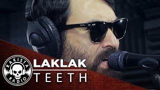 LAKLAK by Teeth  Rakista Live EP148 [upl. by Enyalaj]