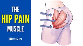 The Hip Pain Muscle How to Release It for INSTANT RELIEF [upl. by Siuol358]