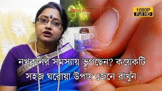 নখকুনির সমস্যায় ভুগছেন কয়েকটি সহজ ঘরোয়া উপায় জেনে রাখুন।  EP 253 [upl. by Sager]