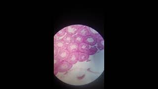 Testis and Epididymis Histology [upl. by Bills]