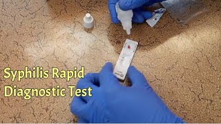 How To Use Syphilis Rapid Diagnostic Test  VDRL Test [upl. by Cassaundra913]