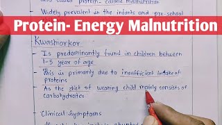 Protein  Energy Malnutrition  Kwashiorkor  Marasmus  Biochemistry [upl. by Yul783]