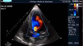 Viewing a cardiac ultrasound doppler Dicom multiframe on medview [upl. by Ardene]