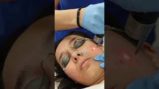 Why Do Dermatologists Recommend PicoSure Laser [upl. by Nelaf565]