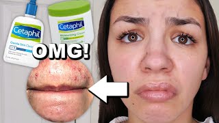 I Used Cetaphil Skincare For One Week [upl. by Narmis438]