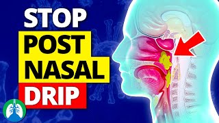 Top 10 Ways to Stop a Cough from Postnasal Drip [upl. by Kirwin22]