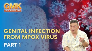 Genital infection from MPOX Virus Part 13  Usapang Pangkalusugan [upl. by Cris584]