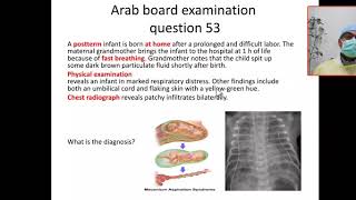 MCQ 53 MAS meconium aspiration syndrome pneumothorax atelectasis chemical pneumonia [upl. by Jenkins]