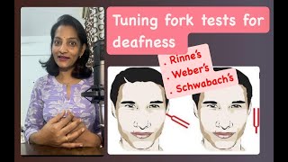 Tuning fork tests for deafness I Clinical physiology I First MBBS I Auditory nerve examination [upl. by Dosh]