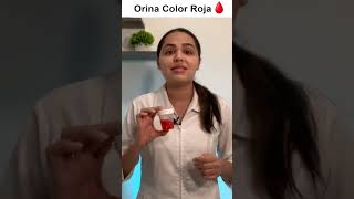 ¿Tu Orina Tiene COLOR ROJO 🩸 salud orina enfermera [upl. by Bigner489]