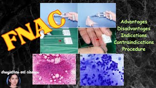 237Fine Needle Aspiration Biopsy  fine needle aspiration cytology fnac surgeryeducation fnac [upl. by Annahs]