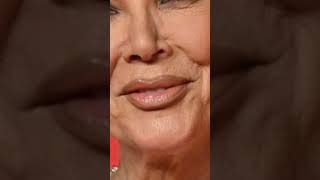 Kris Jenner has a “cyst and a small tumourquot krisjenner [upl. by Ariella]