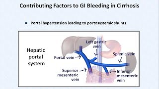 Esophageal Varices and Variceal Hemorrhage [upl. by Einalam422]