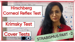 Strabismus Part 2  Hirschberg Corneal Reflex Test  Krimsky Test  Cover Tests [upl. by Ecyor]