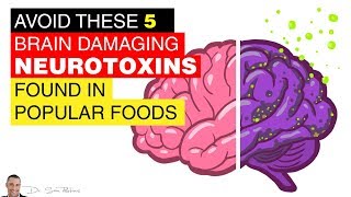 🧠 Avoid These 5 Brain Damaging Neurotoxins Found In Popular Foods  by Dr Sam Robbins [upl. by Oly988]