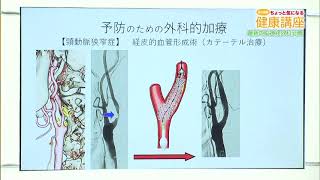 令和4年8月 島大病院ちょっと気になる健康講座「最新の脳神経外科治療」 （脳神経外科 講師 吉金 努） [upl. by Nwonknu]