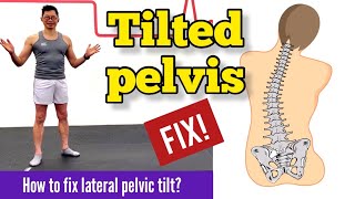 The Surprising Truth About Lateral Pelvic Tilt  Prevent it 2023 [upl. by Yhotmit184]