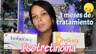 3 meses de tratamiento usando isotretinoina [upl. by Ailey]