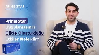 PrimeStar uygulamasının ciltte oluşturduğu etkiler nelerdir [upl. by Previdi]