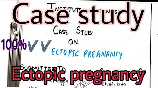 CASE Study on ectopic pregnancy case presentation on ectopic pregnancy NCP on ectopic pregnancy [upl. by Marcella332]