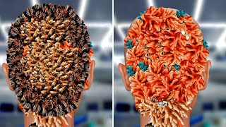 ASMR Removed Flying 😔 Bees Making Honey Comb on Head infection treatment Asmr animation bkasmr20 [upl. by Winikka567]