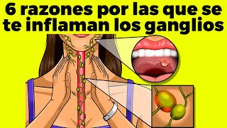 6 RAZONES POR LAS QUE SE TE INFLAMAN LOS GANGLIOS [upl. by Angid335]