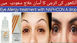 Eye Allergy treatment with Naphcon A drops  how to use Naphcon drop  Ankh ki Allergy ka ilaj [upl. by Nyrb]