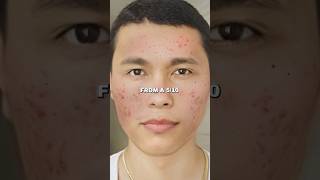 Zuniga on Natural Face Mask Glow Up in 7 Days [upl. by Tatianas31]