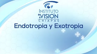 Endotropia y exotropia [upl. by Ahsekal56]