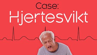 Case 2 Hjertesvikt [upl. by Arval]