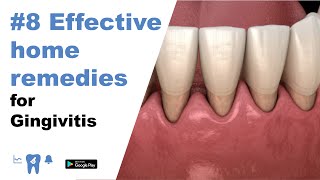 8 Effective home remedies for gingivitis [upl. by Anaicul838]