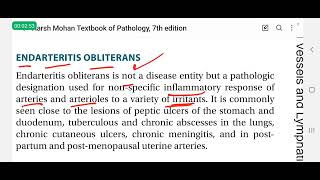 Endarteritis obliterans in Hindi  pathology lectures [upl. by Rocky]