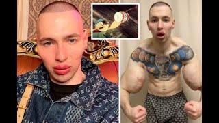 Russian Popeye ignores doc death warning to undergo extreme alien face surgery [upl. by Letsirc]