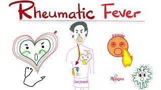 Rheumatic Fever  Jones Criteria  Causes Signs Symptoms Diagnosis amp Treatment  Cardiology [upl. by Eliathan365]