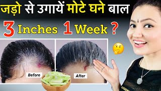 30 Days quotExtreme Hair Growthquot Challenge  बेजान Bald पड़ चुकी जड़ो से भी होगी कमाल की Hair Growth❤️ [upl. by Mccallum]